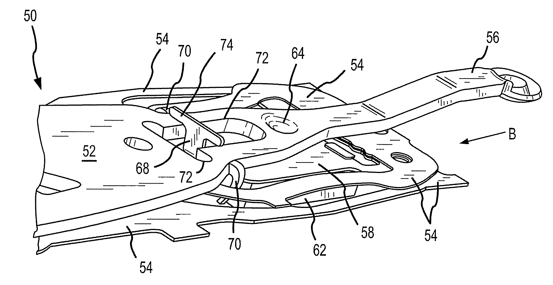 Suspension Buckling Limiter