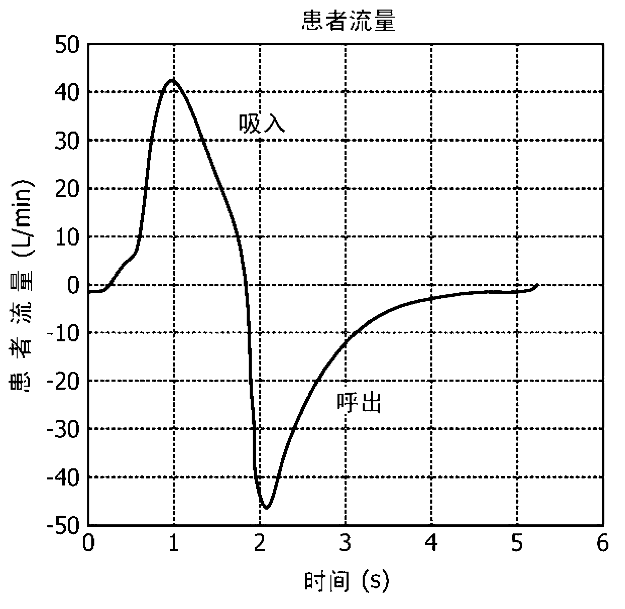 Automatically controlled ventilation system