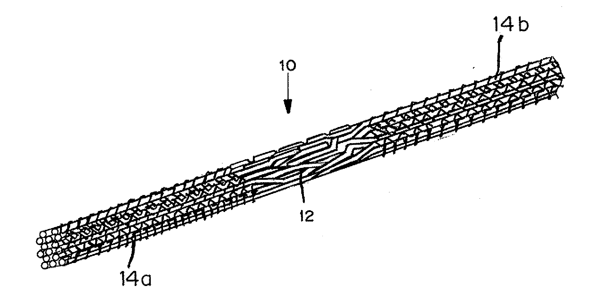 Mechanically competent scaffold for ligament and tendon regeneration