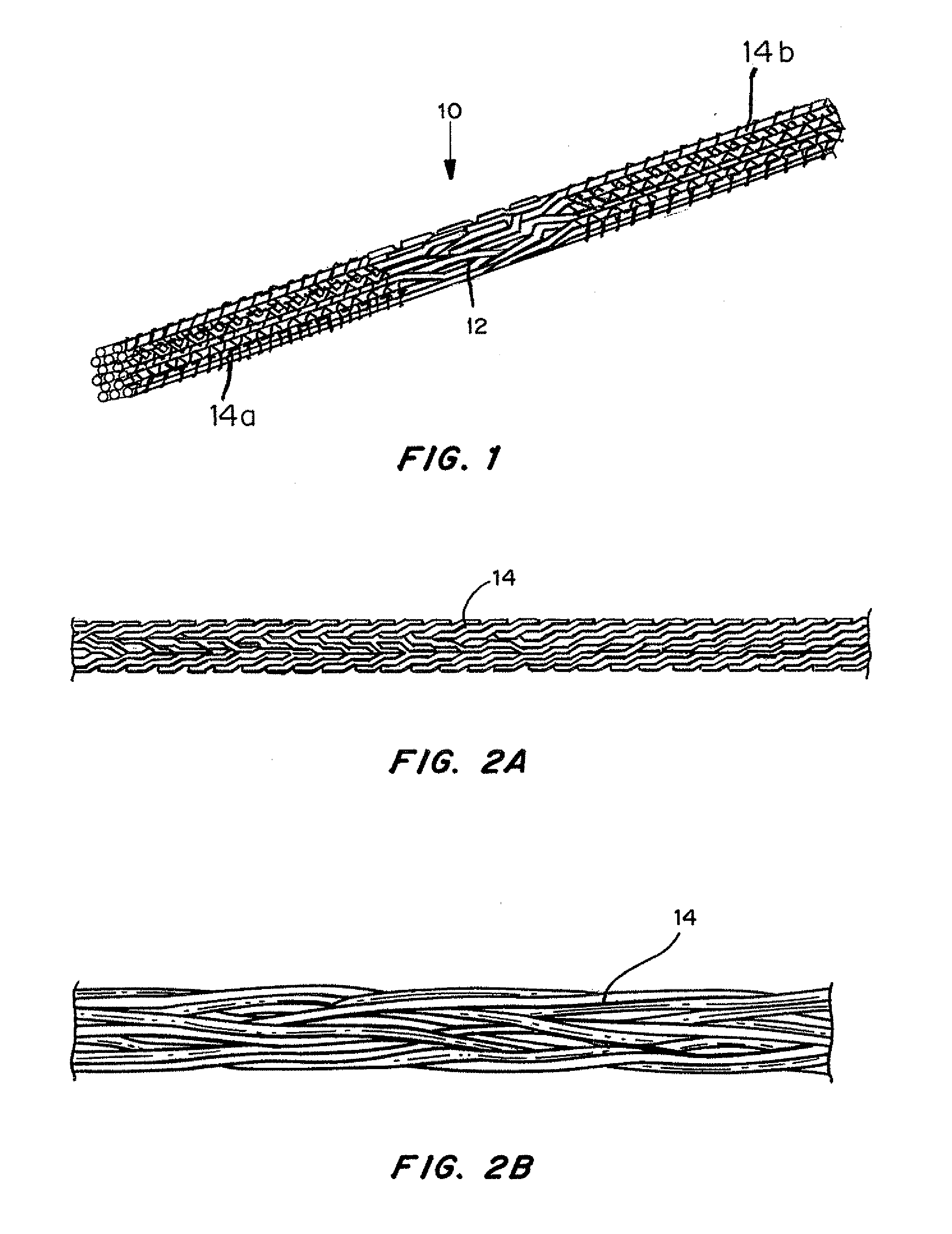 Mechanically competent scaffold for ligament and tendon regeneration