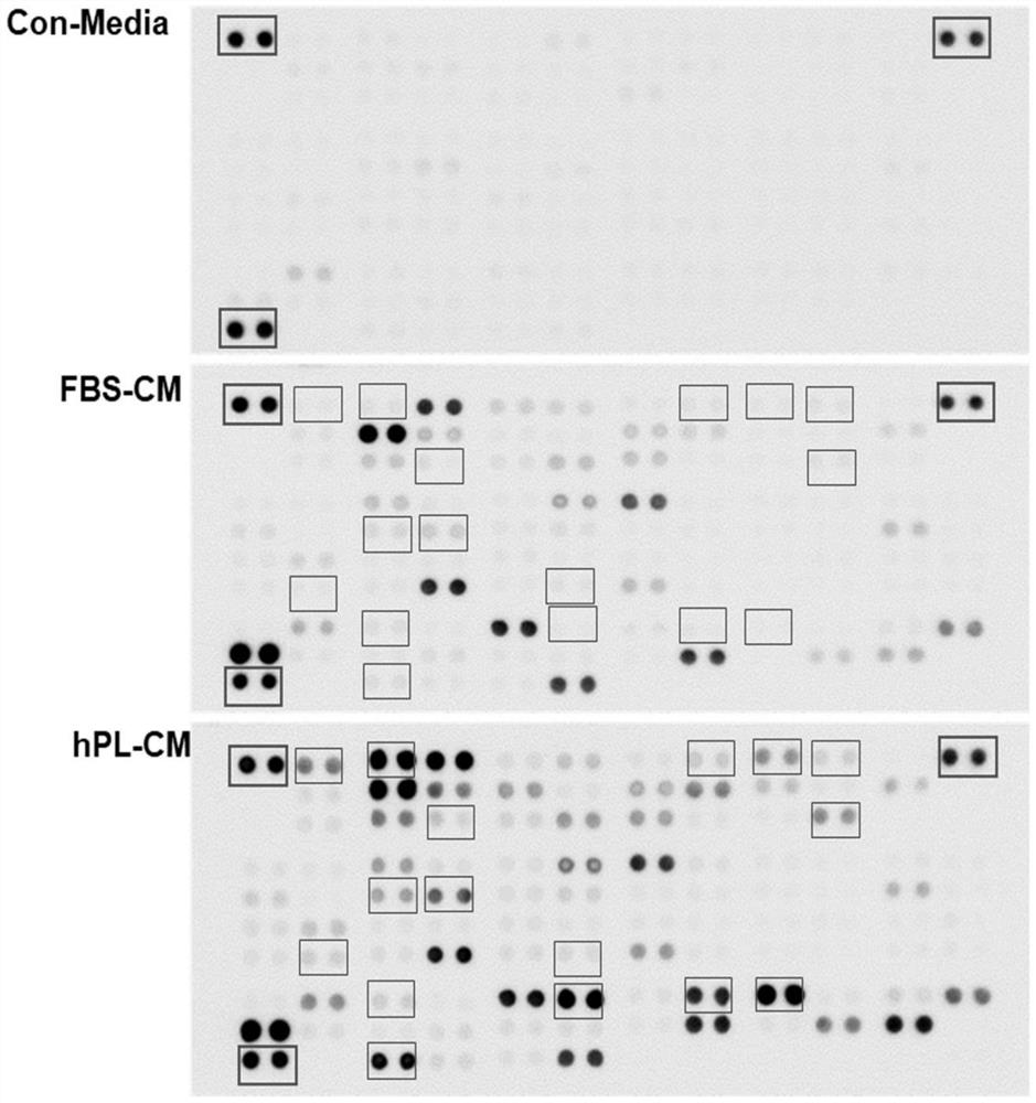 Cosmetic composition comprising culture solution of mesenchymal stem cells cultured in hpl-containing medium