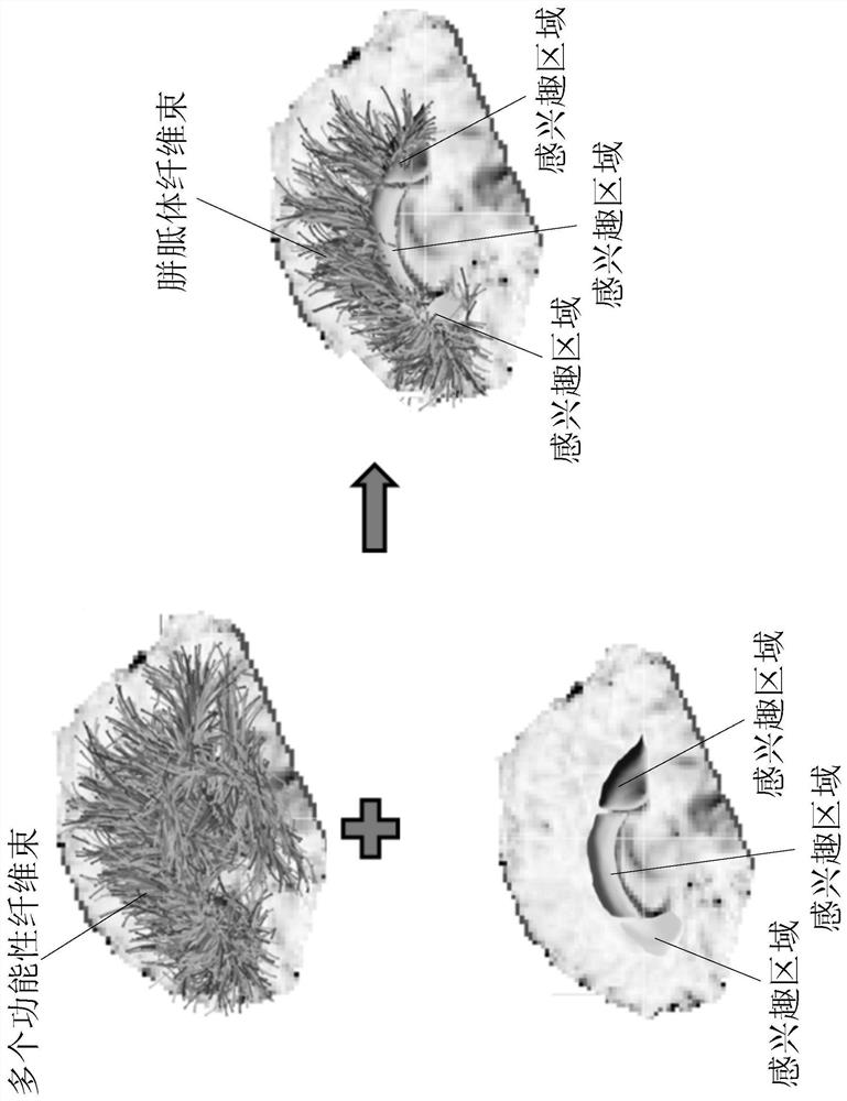 Medical image processing device and medical image processing method