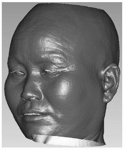 Craniofacial reconstruction method