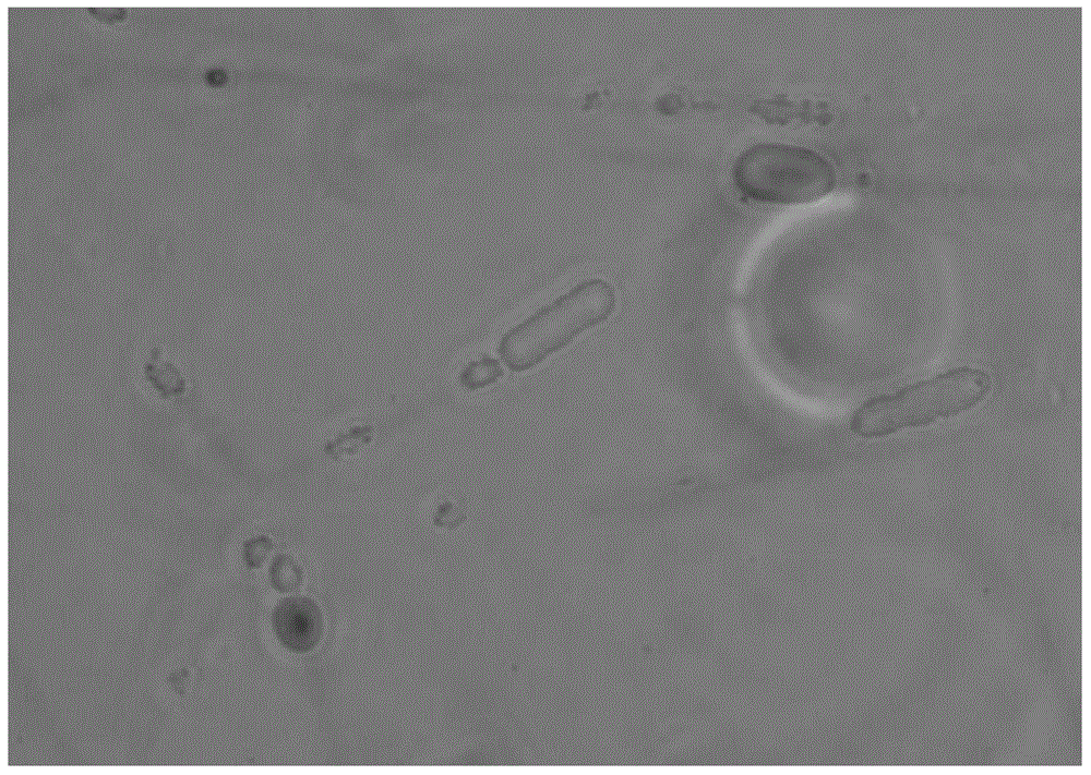 Method for preparing flax fiber by ultrasonic combination of mucor circinelloides DK1 strain and hydrogen peroxide