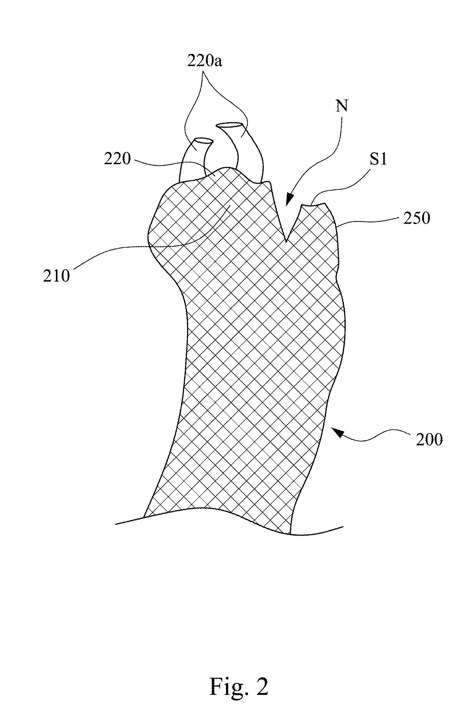 Tibial base plate and method for attaching a tibial base plate on a tibia