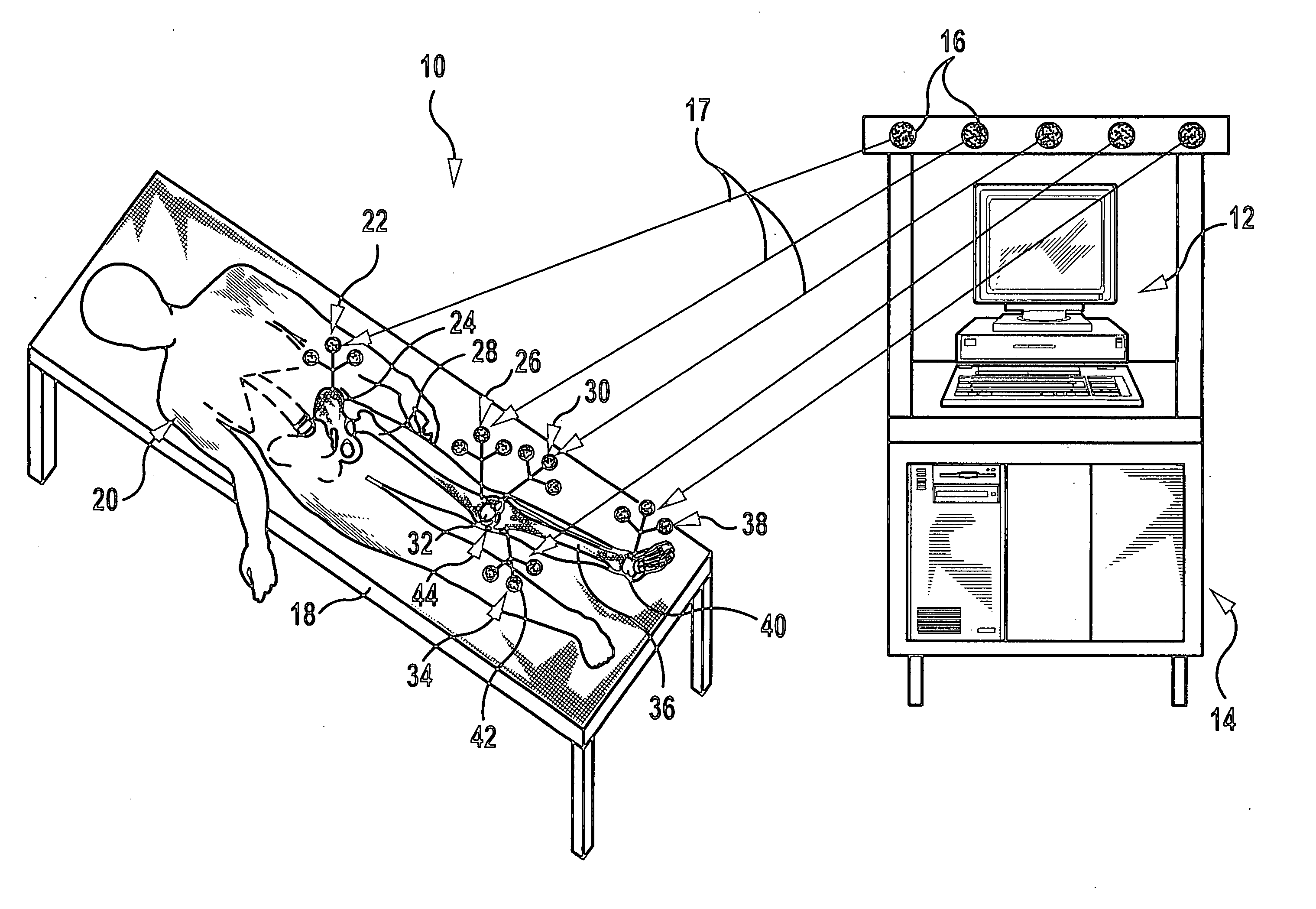 Patella reference device