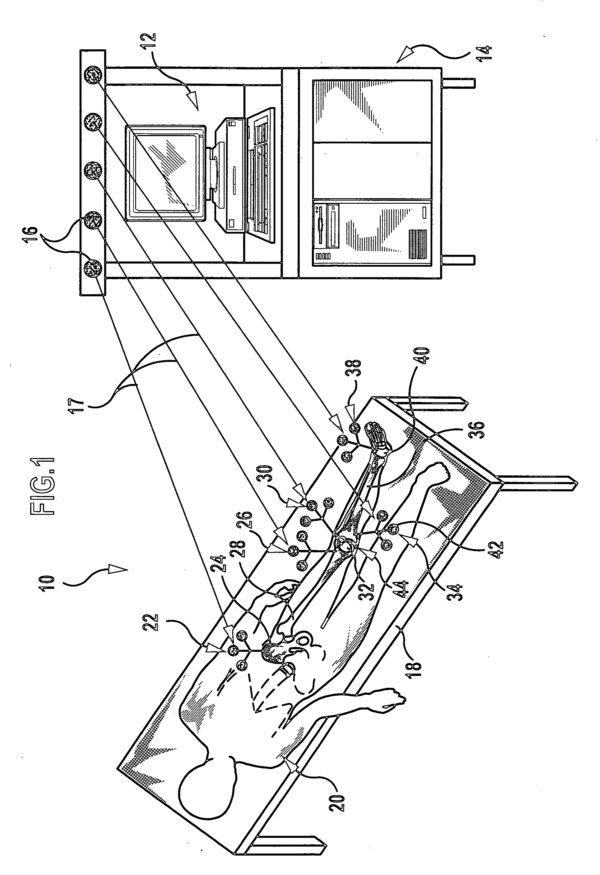 Patella reference device