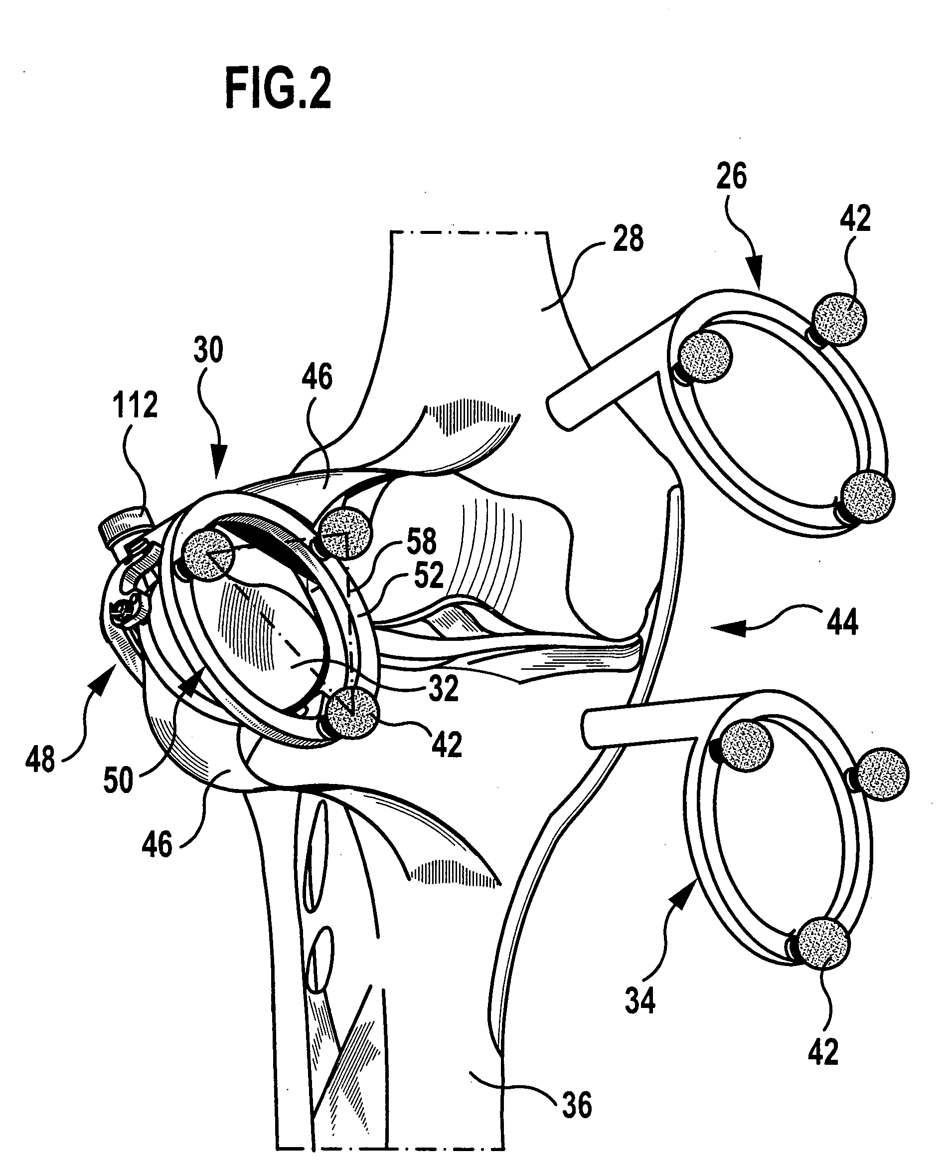 Patella reference device