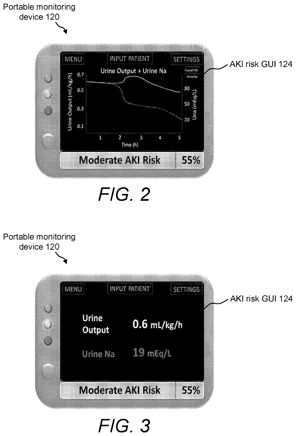 System and urine sensing devices for and method of monitoring kidney function