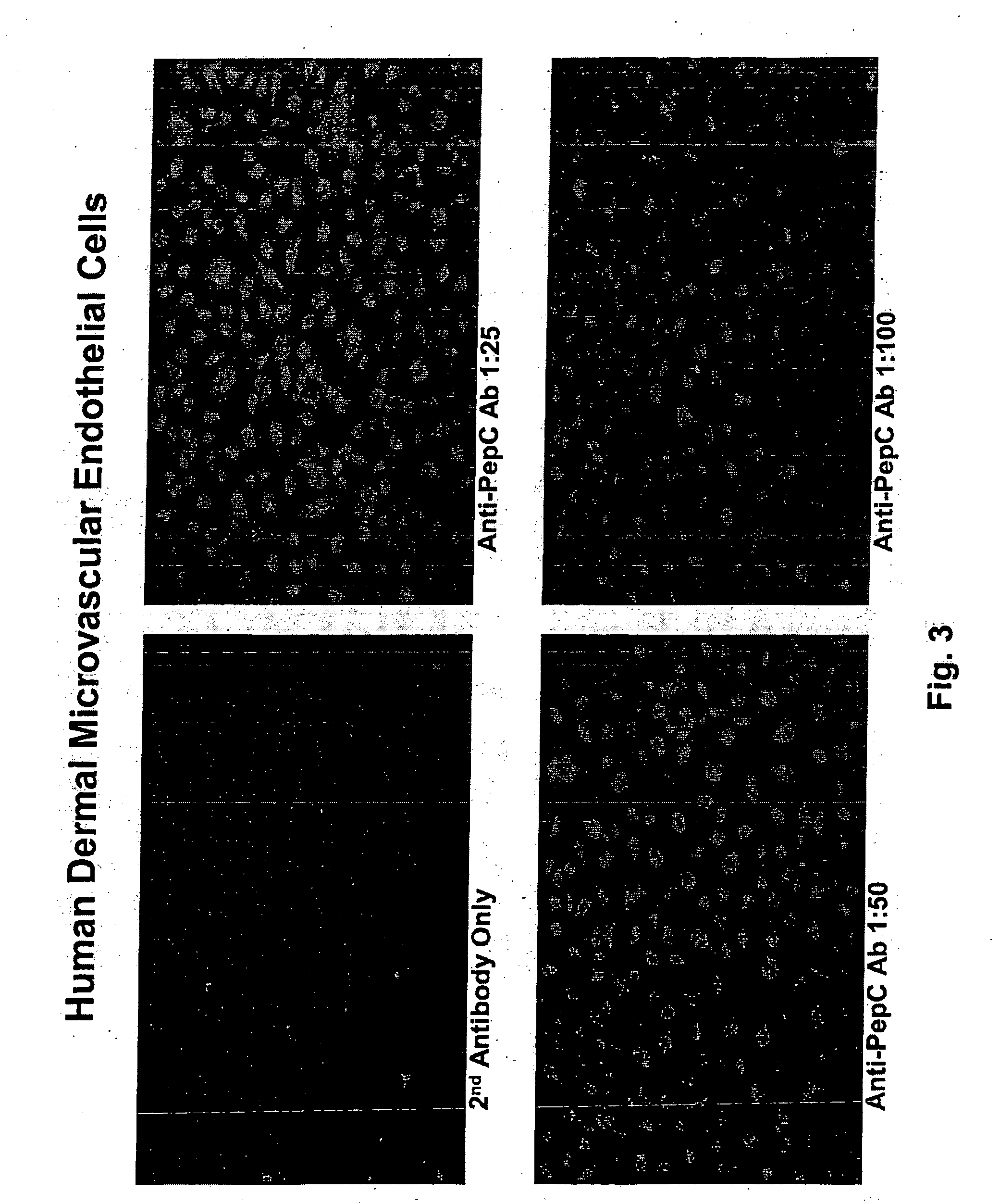 Receptor for lysophosphatidylcholine in vascular endothelial cells and use thereof