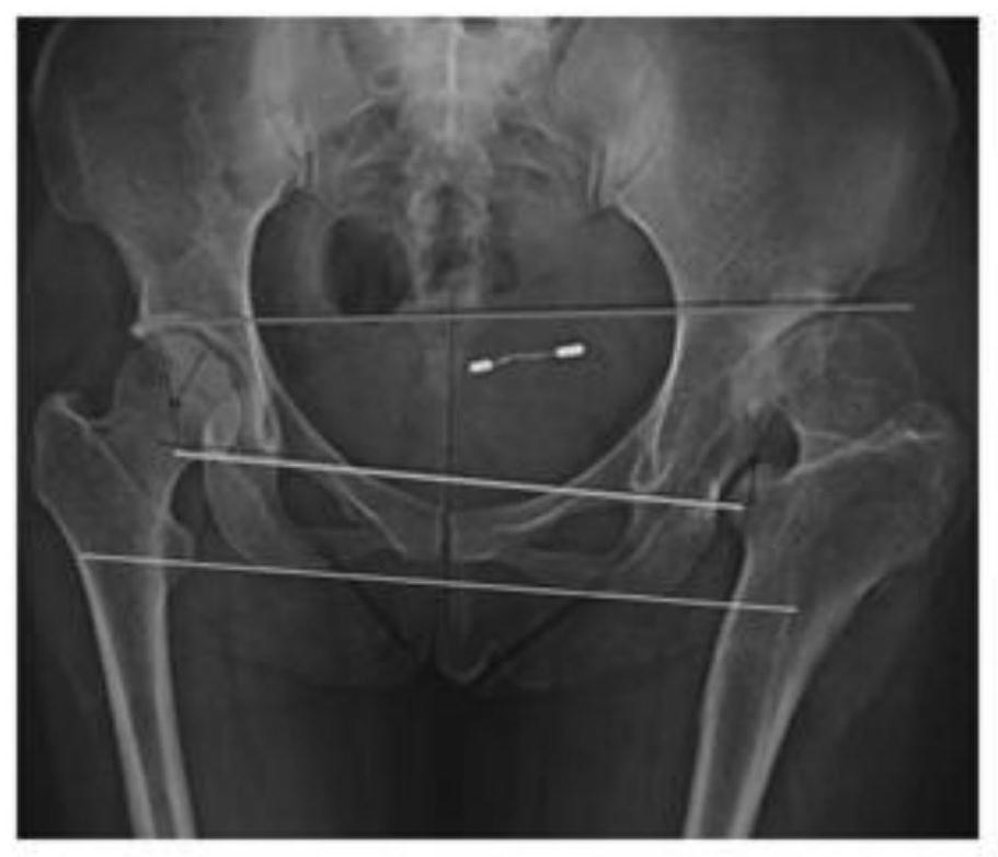 Device for automatically diagnosing orthopedic diseases based on medical image information