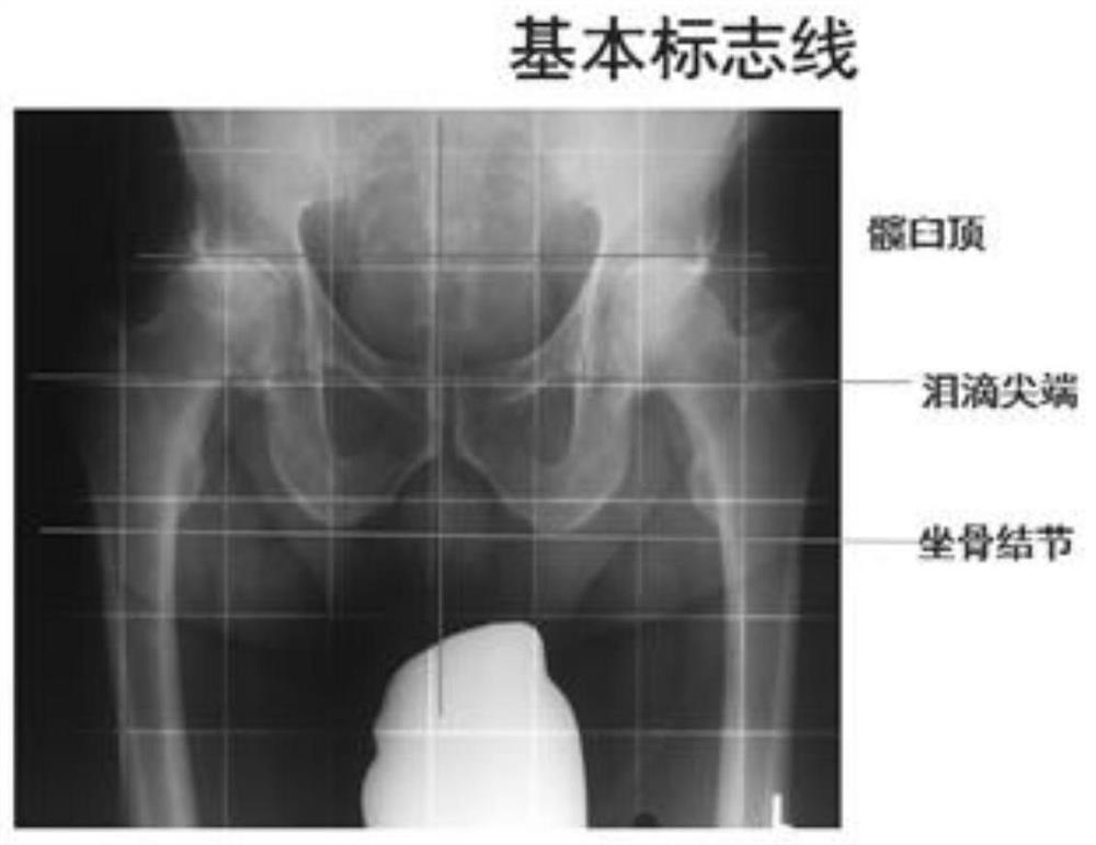 Device for automatically diagnosing orthopedic diseases based on medical image information