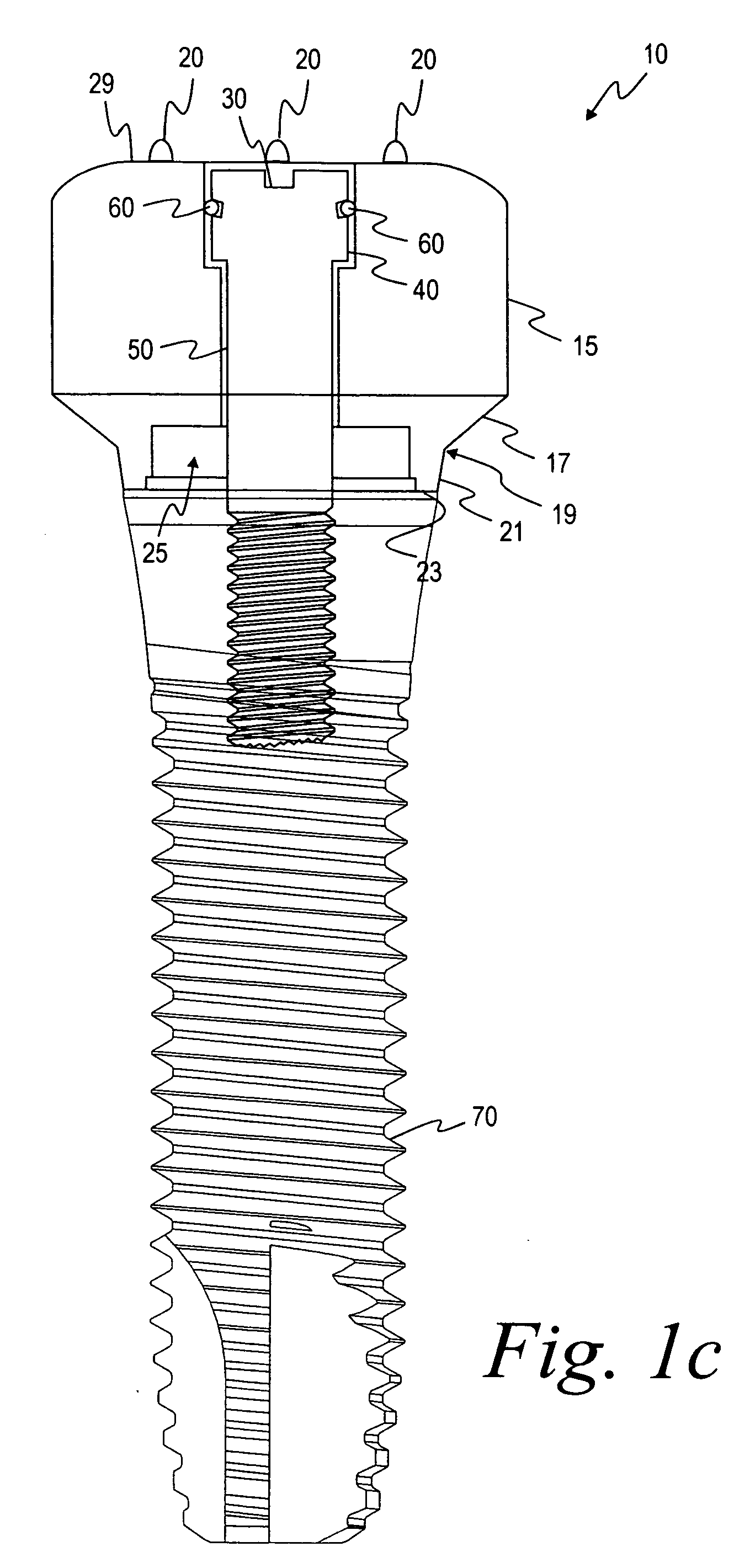 Methods for placing an implant analog in a physical model of the patient's mouth