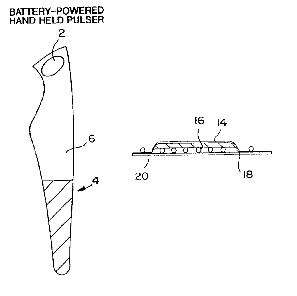 Method and apparatus for electrically assisted topical delivery of agents for cosmetic applications