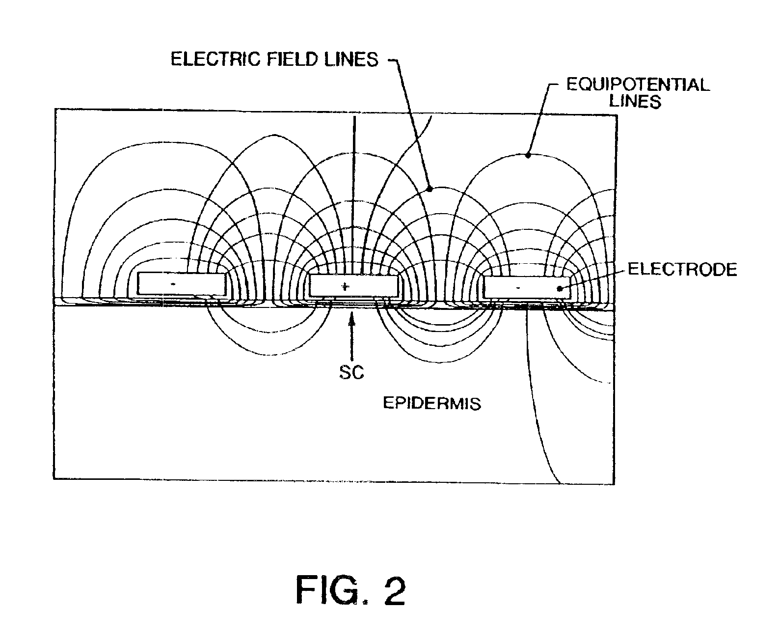 Method and apparatus for electrically assisted topical delivery of agents for cosmetic applications