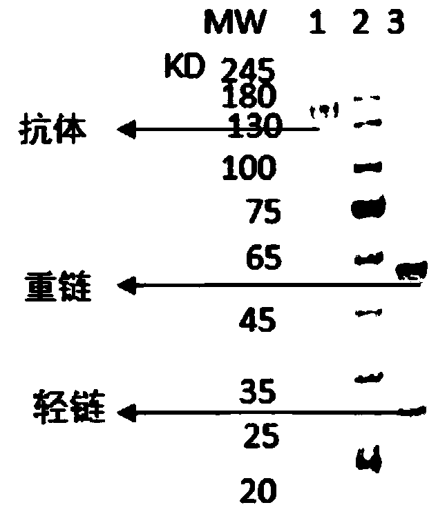 A kind of neutralizing antibody against tetanus toxin and its application