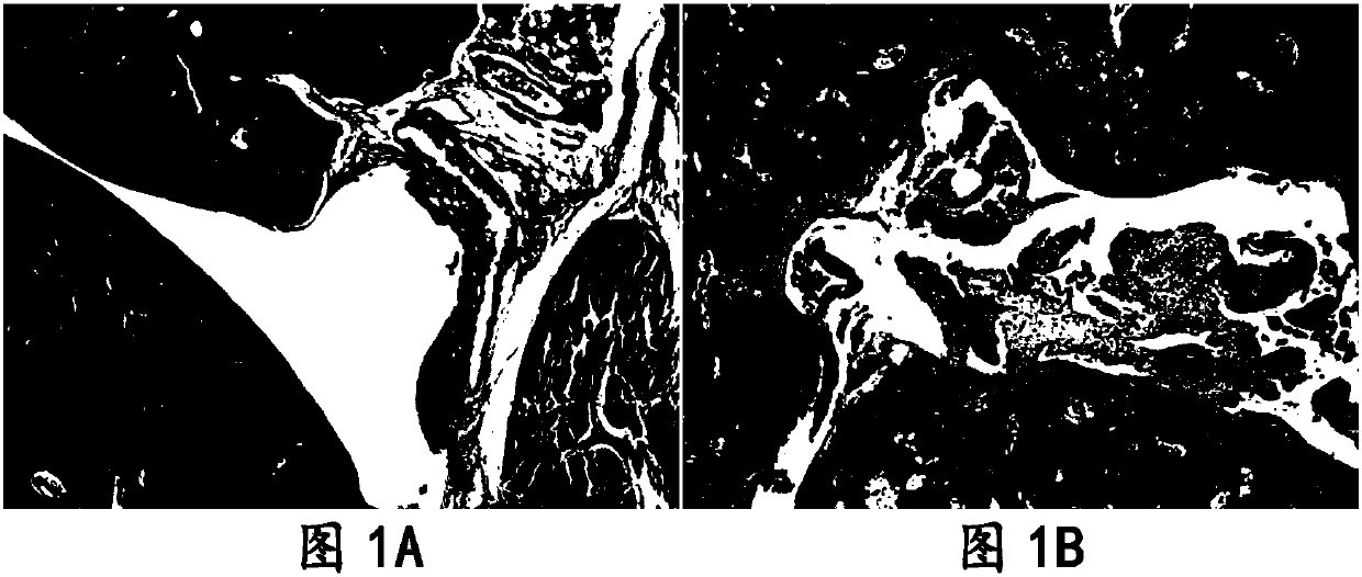 Application of polygonum cuspidatum, polydatin and emodin in treatment of rheumatoid arthritis