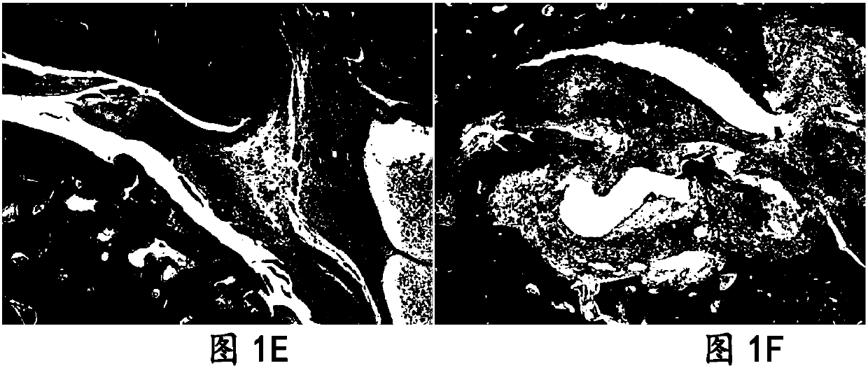 Application of polygonum cuspidatum, polydatin and emodin in treatment of rheumatoid arthritis