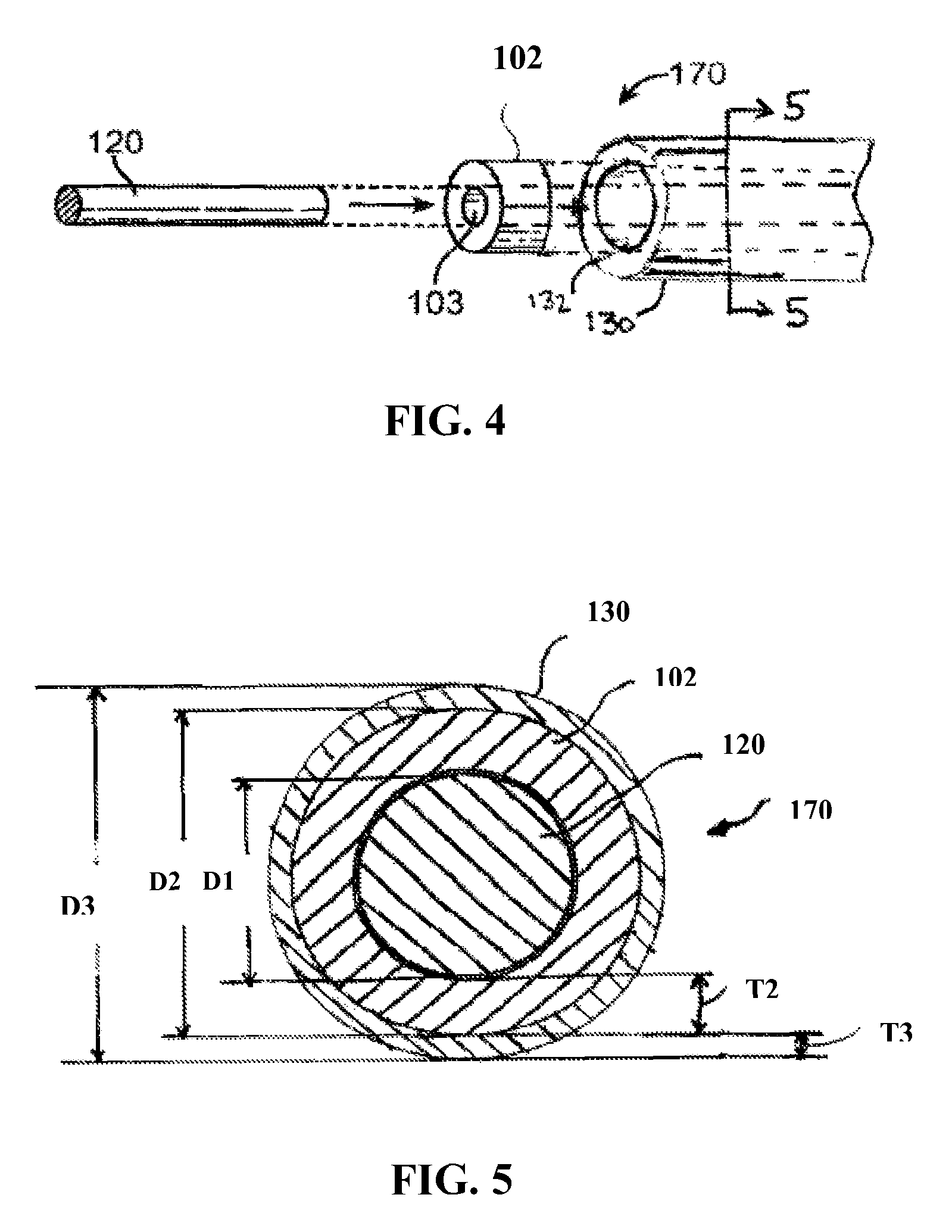 Method of forming a nitinol stent