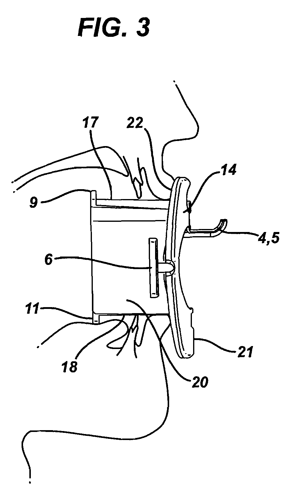 Endoscopic bite block for use with cannula