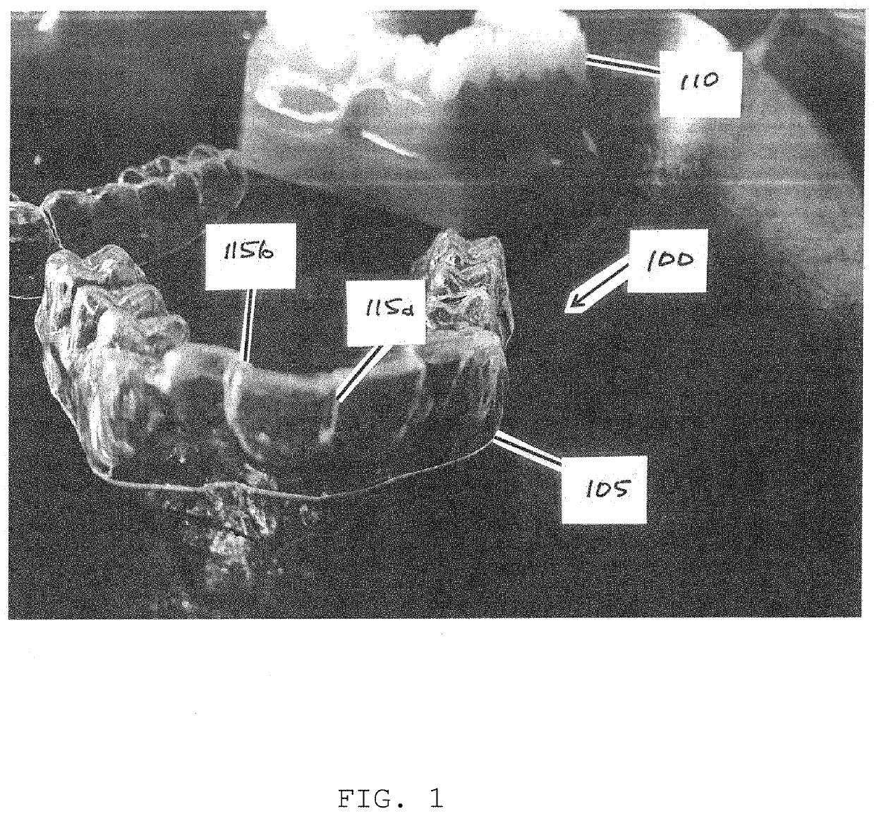 Device and method for interproximal reduction