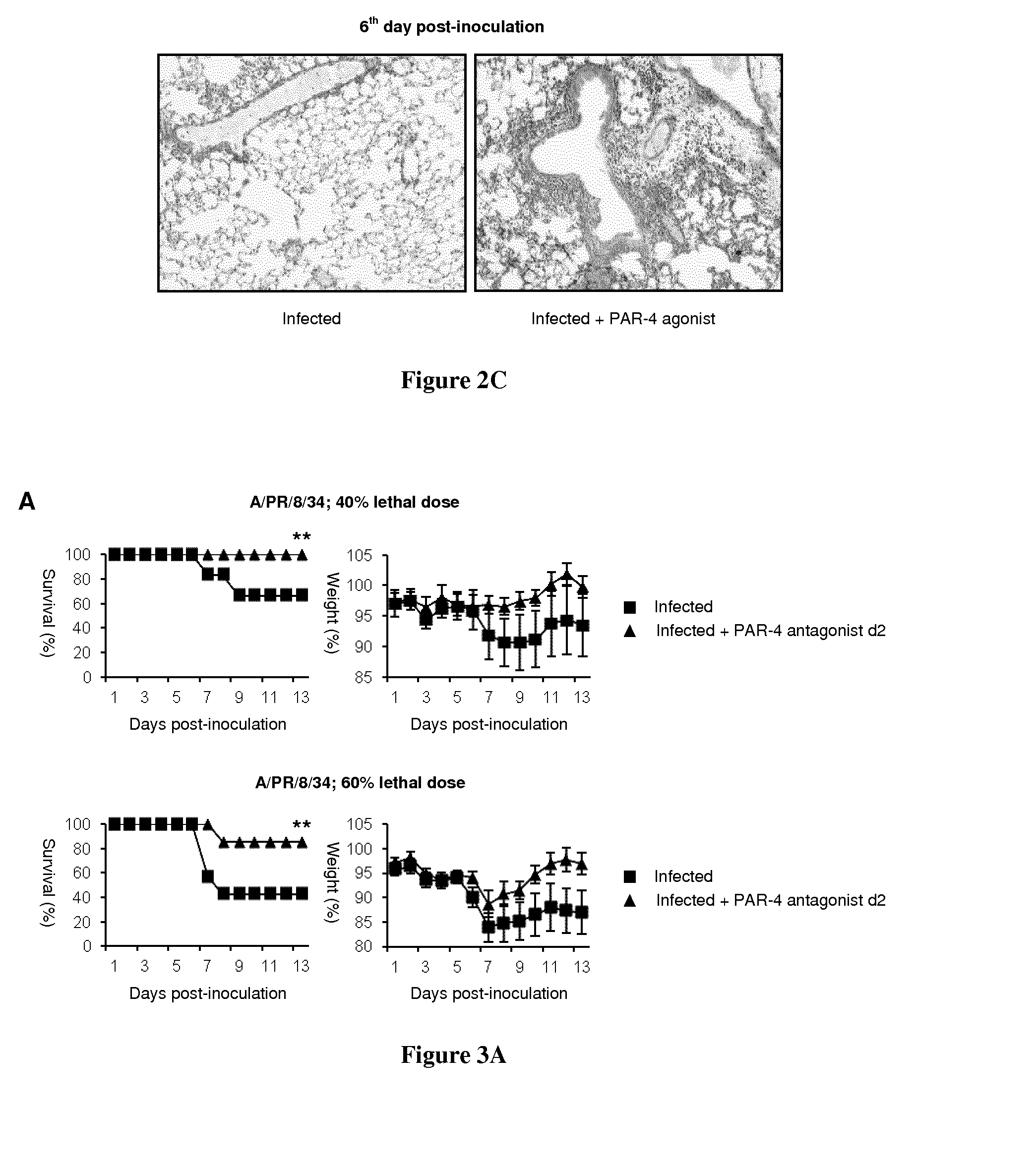 Par-4 antagonists for use in the treatment or prevention of influenza virus type a infections