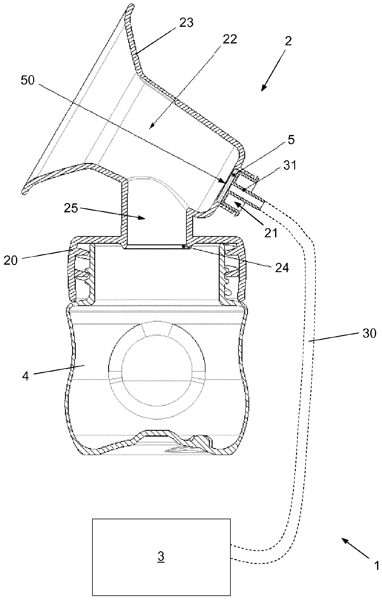 Expression kit for breast pump device