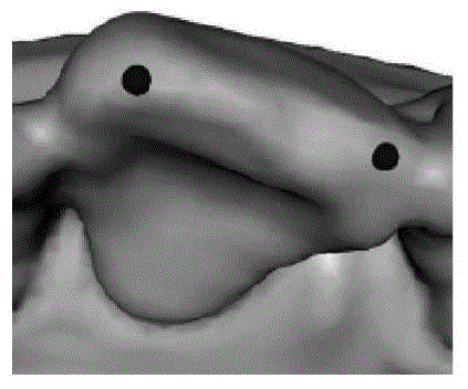 Computer interaction type method for segmenting single tooth crown from three-dimensional jaw model