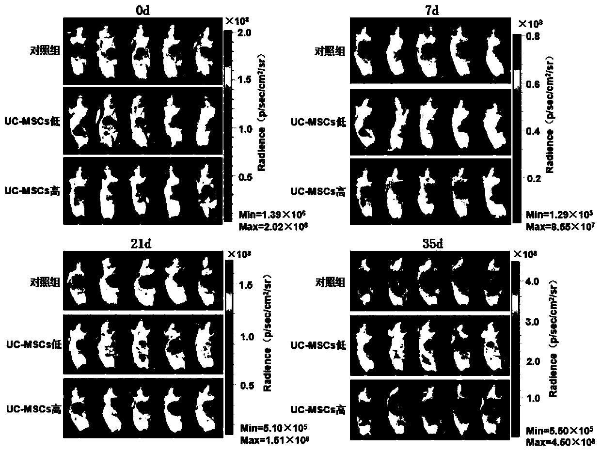 Experimental method for preventing generation and growth of liver cancer by using umbilical cord mesenchymal stem cells