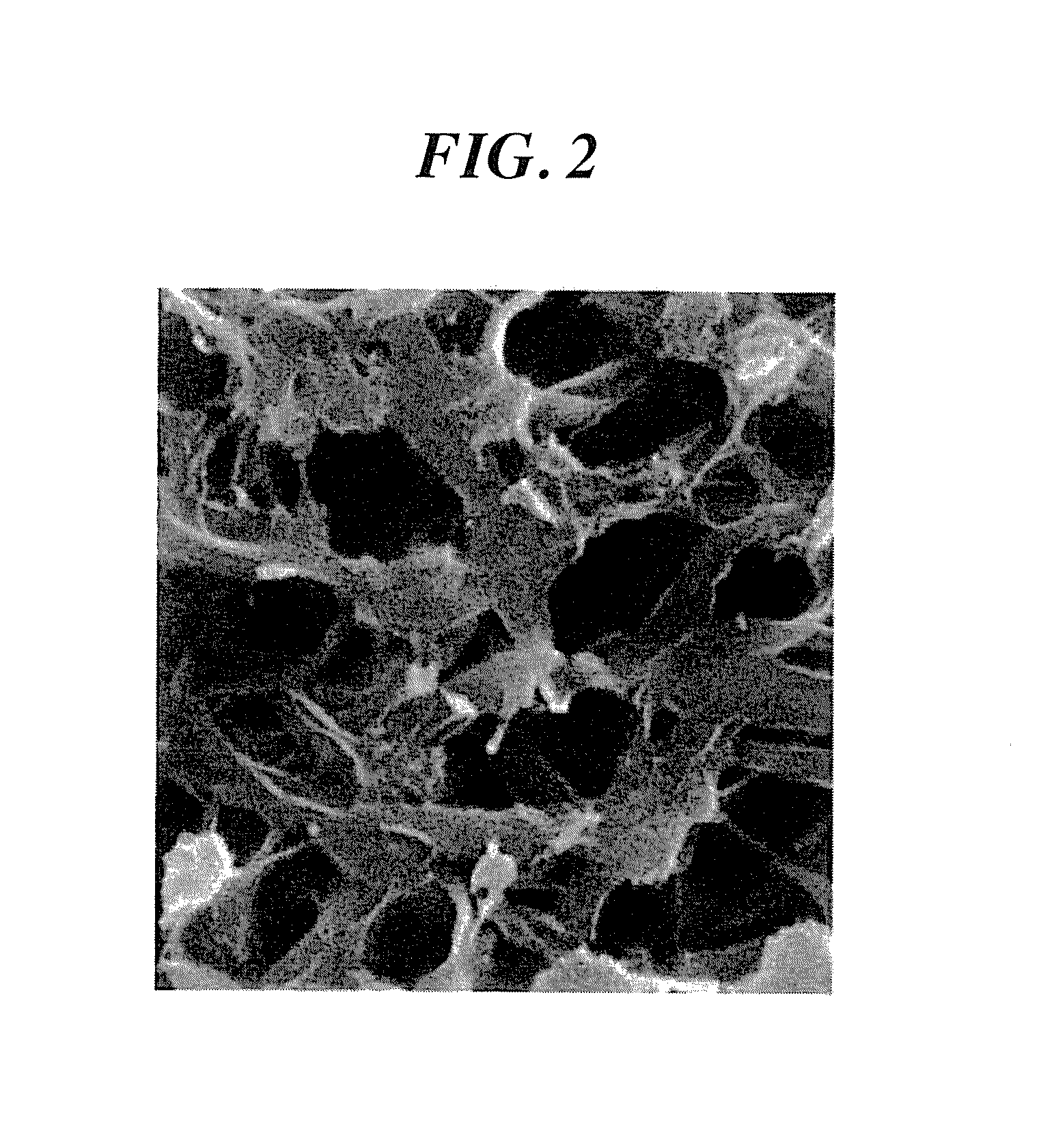 Microporous membrane and manufacturing process therefor