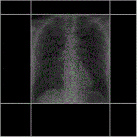 Radiation field control method and device for medical X-ray system