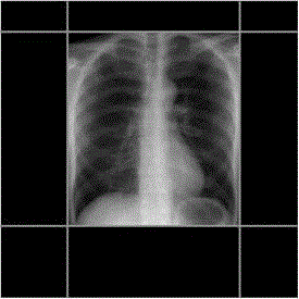 Radiation field control method and device for medical X-ray system