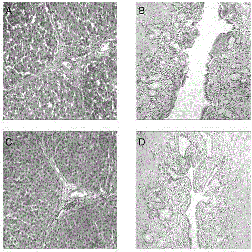 Perfusion preservation fluid for isolated liver