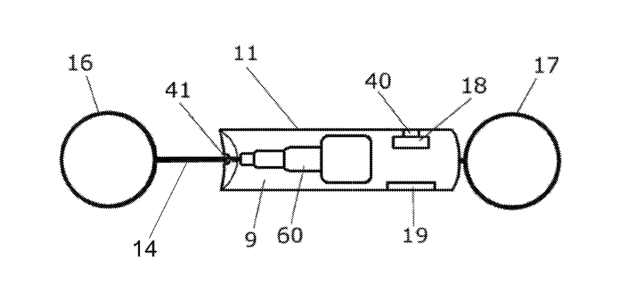 Remote controlled retractable leg restraint device