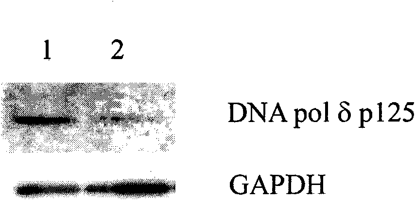 Carcinoembryonic antigen positive cell targeted gene expression element CPD and application thereof