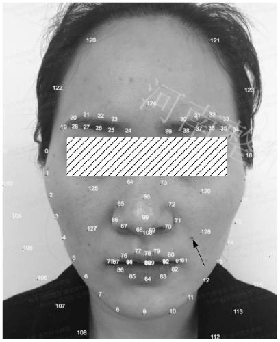 Image processing method and device, electronic equipment and storage medium