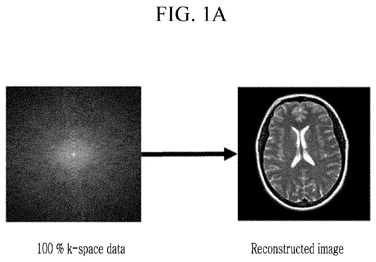 Apparatus and method for reconstructing magnetic resonance image using learning, and under-sampling apparatus method and recording medium thereof