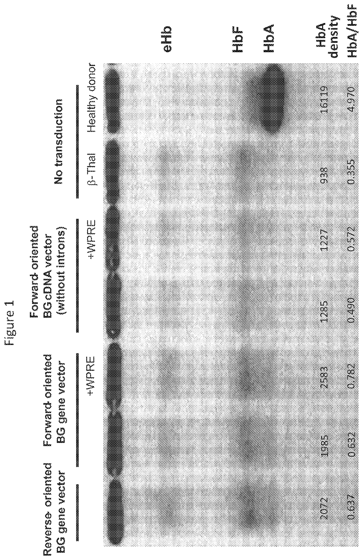 Lentiviral vector for treating hemoglobin disorders