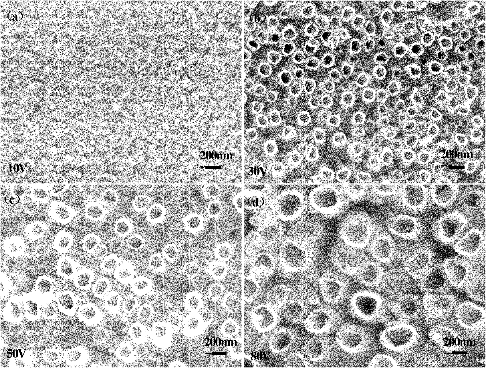 Surface treatment method for improving bioactivity of medical beta-type titanium alloy surface