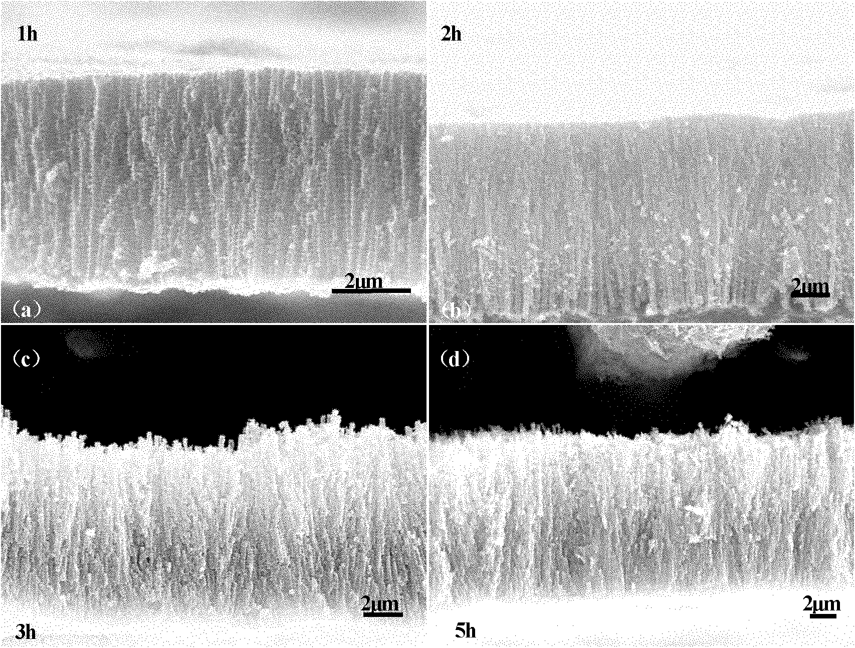 Surface treatment method for improving bioactivity of medical beta-type titanium alloy surface