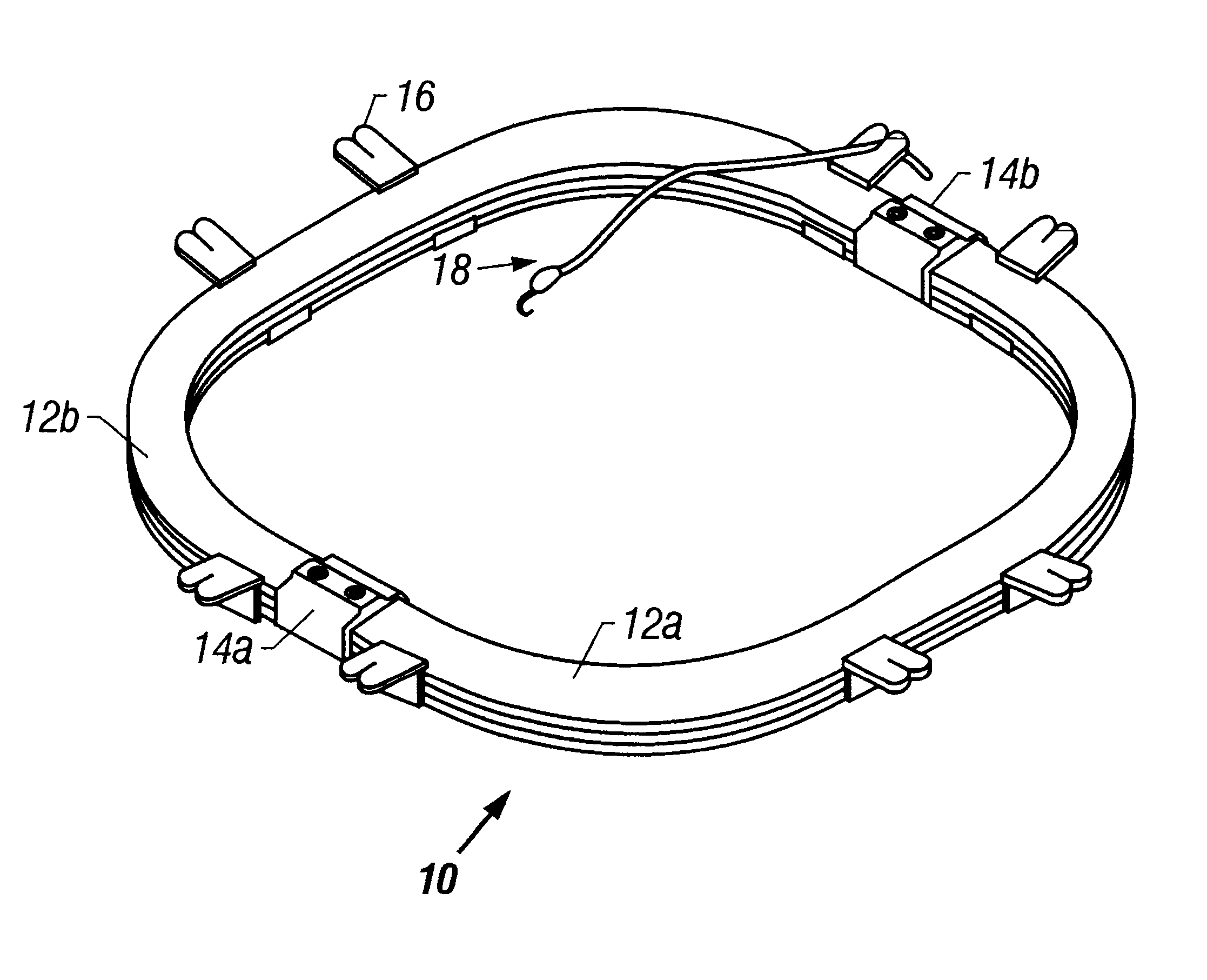 Variable geometry retractor and disposable retractor stay clips and method of use