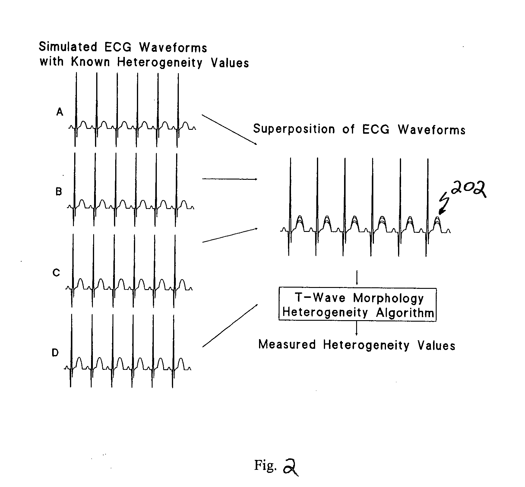 Spatial heterogeneity of repolarization waveform amplitude to assess risk of sudden cardiac death