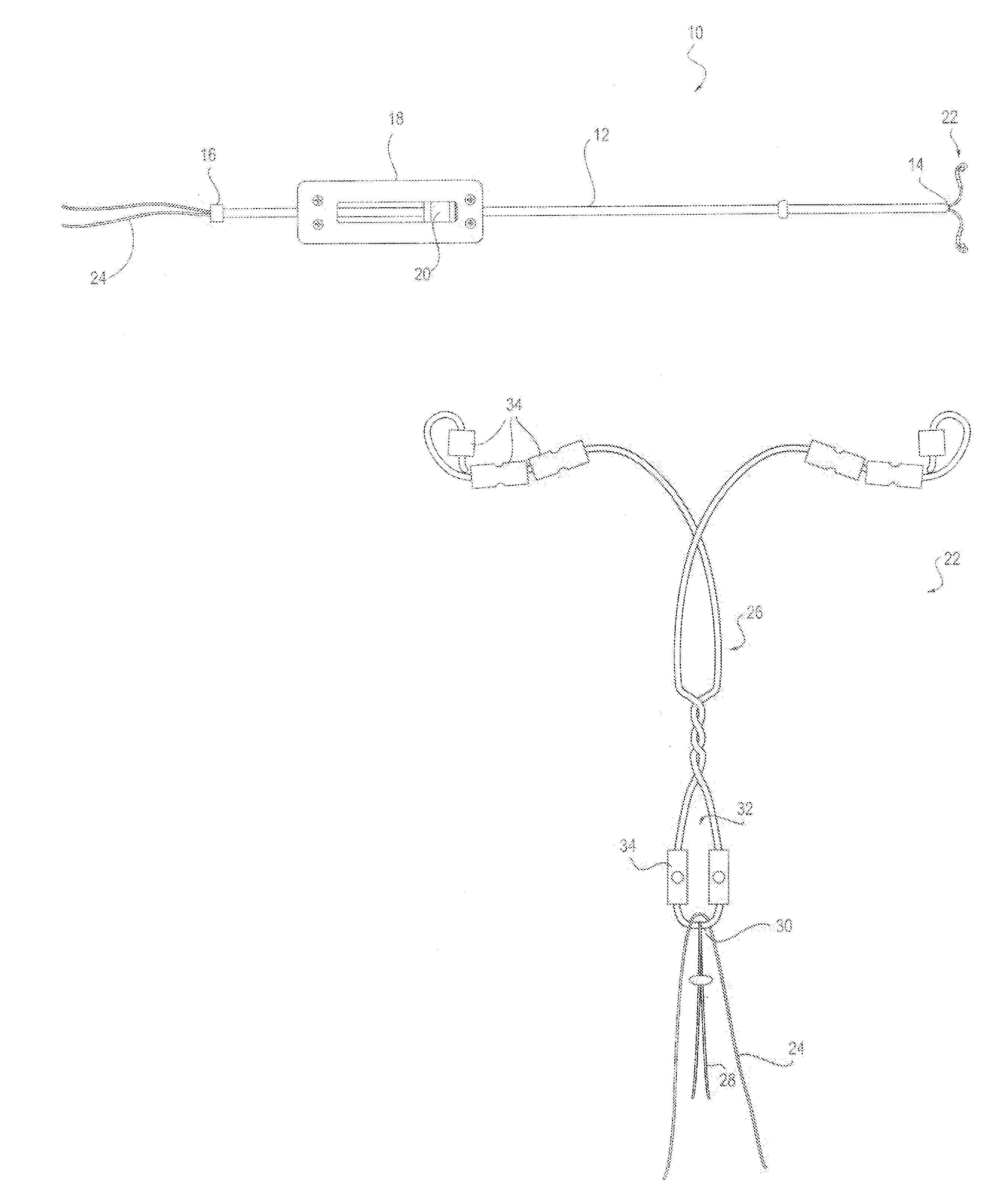 Intrauterine device with retrieval thread