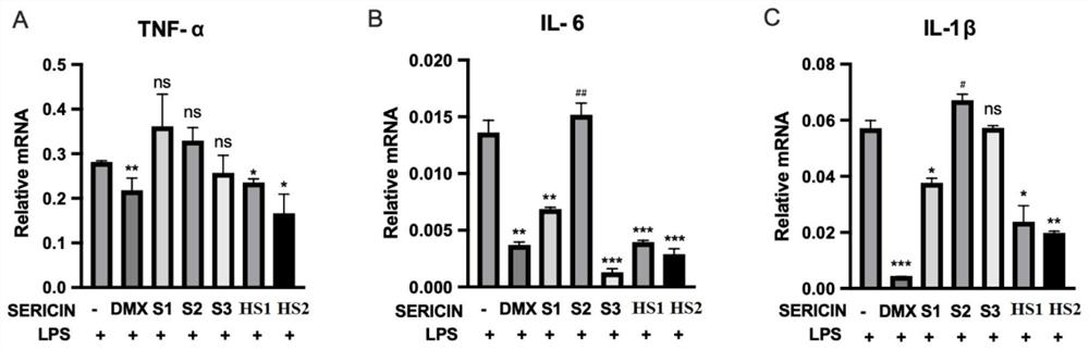 Anti-inflammatory sericin peptide and its application