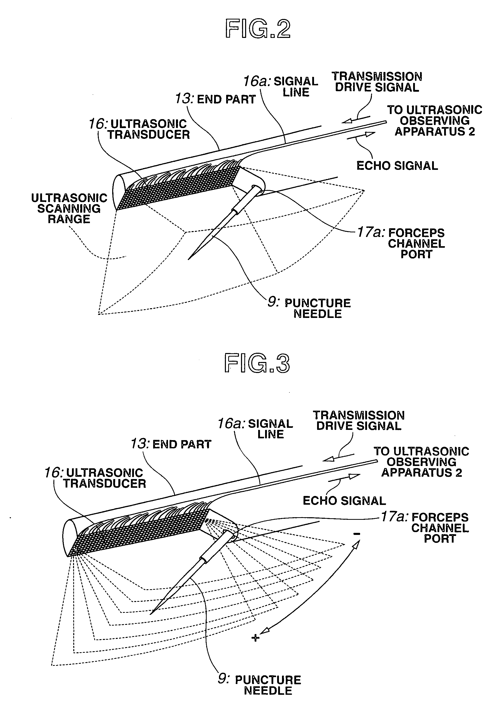 Ultrasonic diagnosis apparatus