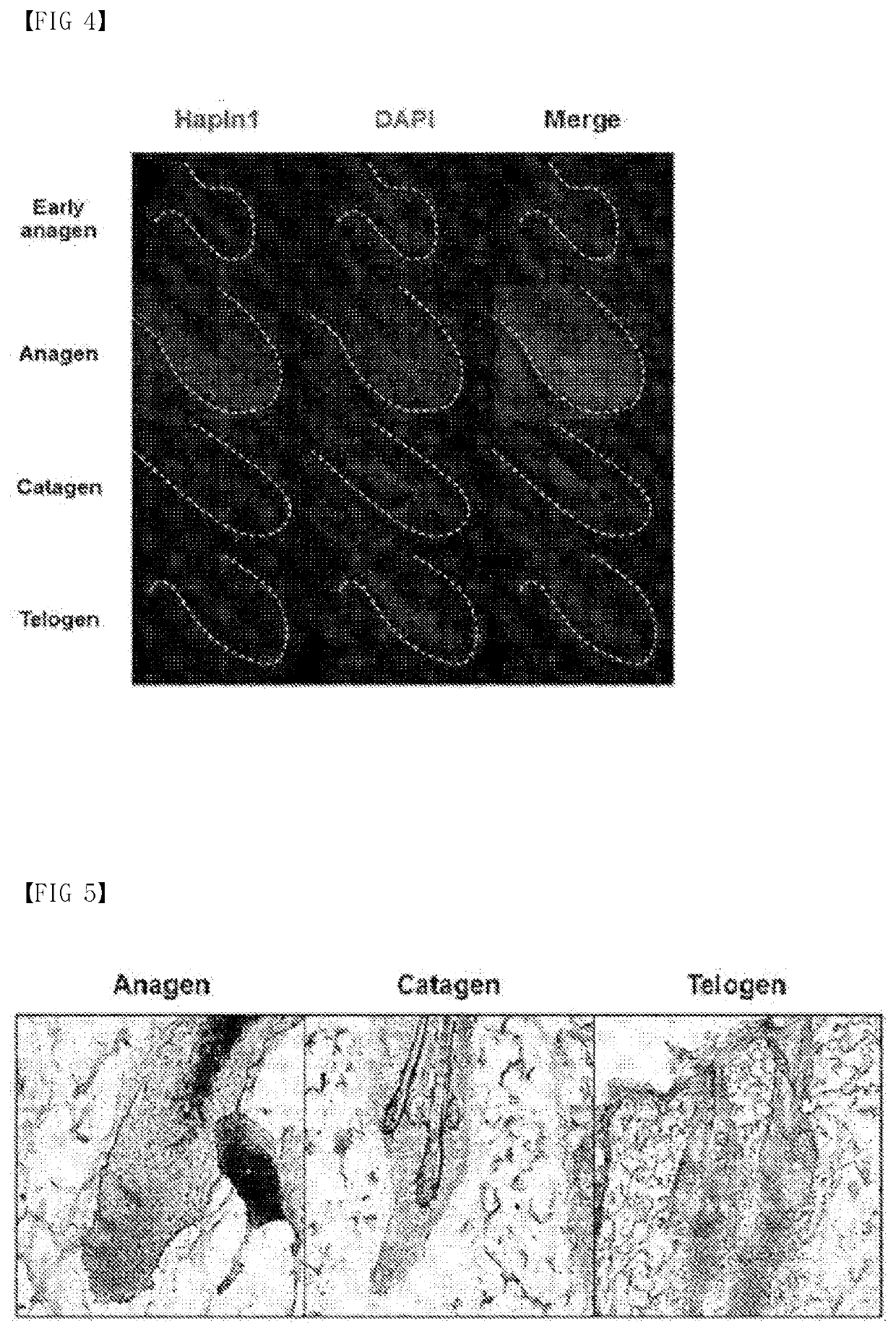 Composition for prevention or treatment of hair loss including hapln1