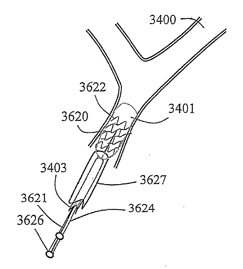 Clot retrieval devices