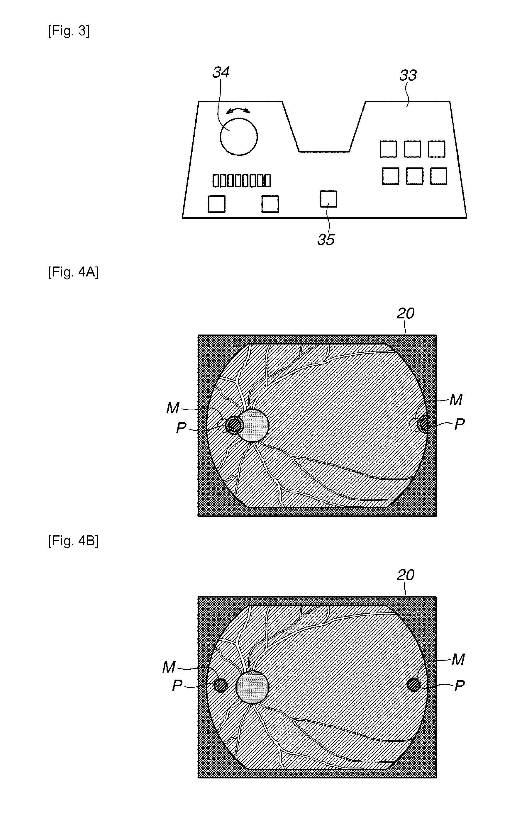 Ophthalmologic observation and photographing apparatus