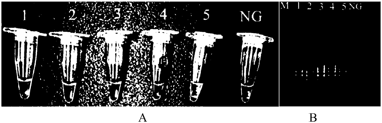 Primer, kit and method for detecting bacillus coli shiga toxin through PSR (Polymerase Spiral Reaction) isothermal amplification reaction detection