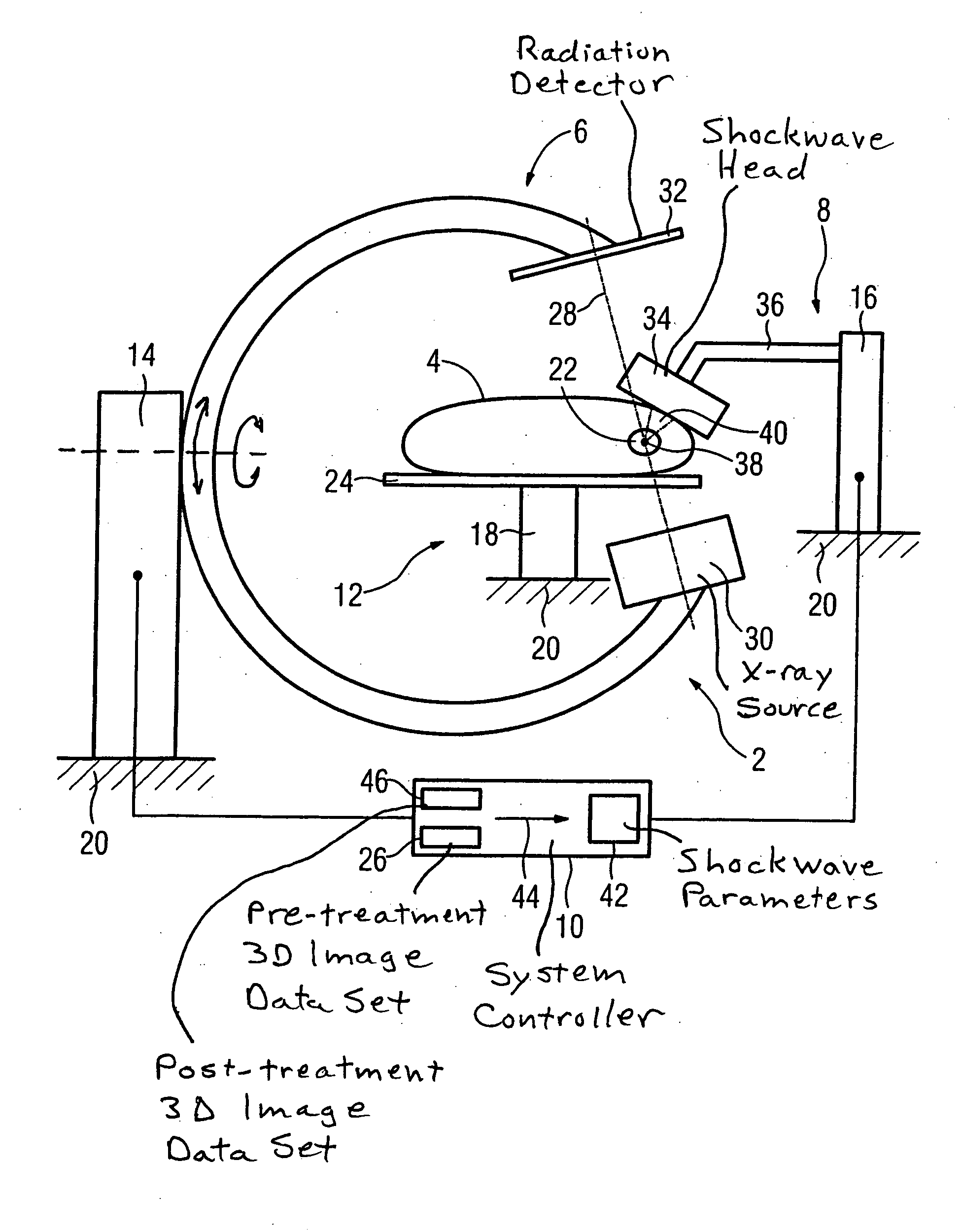 Lithotripsy method and system without patient relocation between diagnostic imaging and treatment